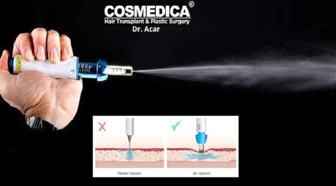 est'_li_bolevie_ochycheniya