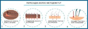 Метод FUT