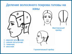 Реконструирование передней линии волос